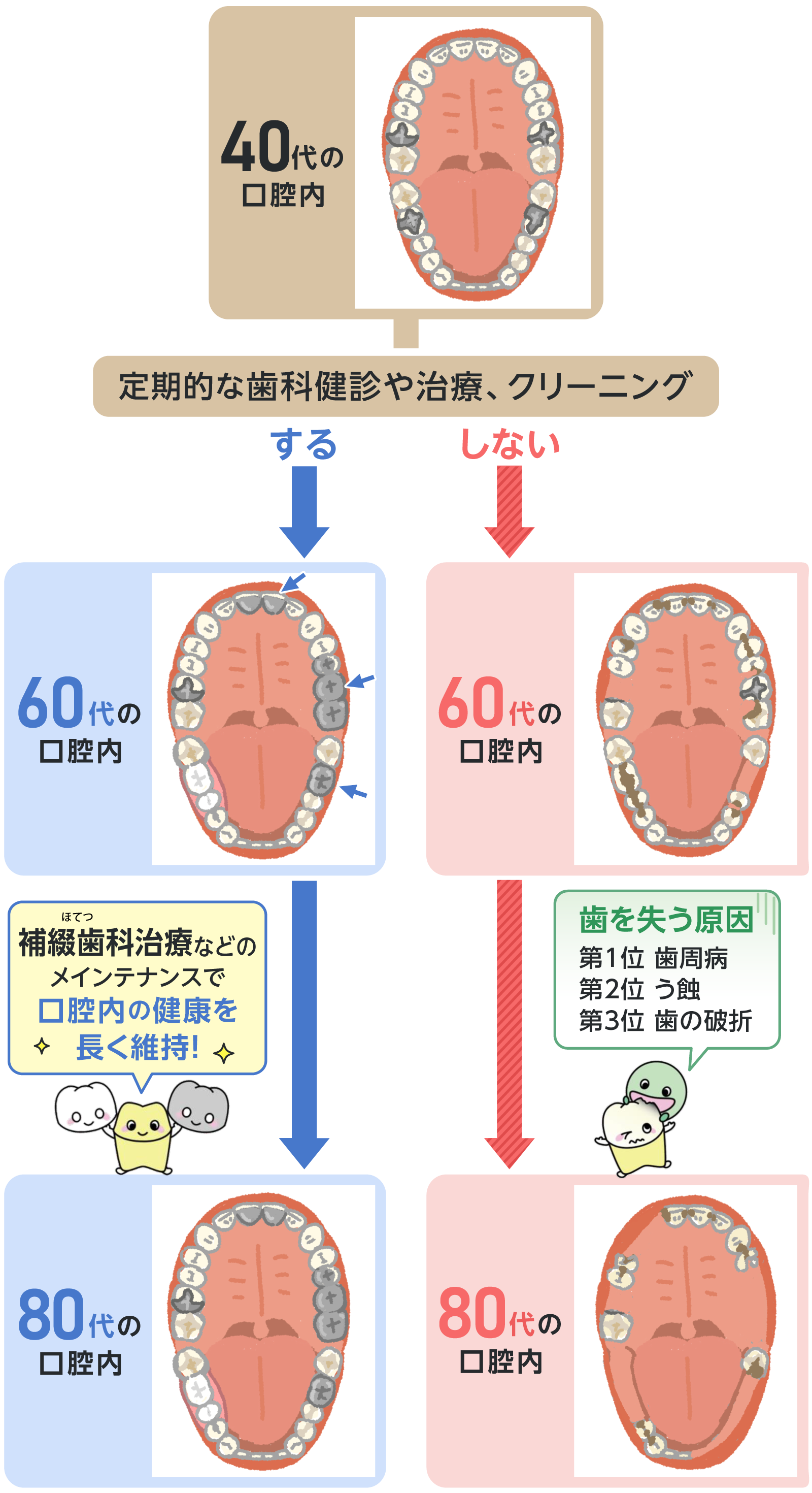 日本補綴（ほてつ）歯科学会 | 補綴歯科ってどんな治療？